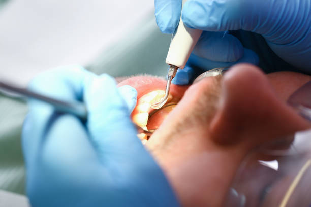 Best Chipped Tooth Repair Near Me  in Union, NJ