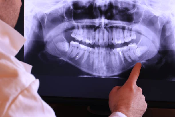 Best Emergency Tooth Extraction  in Union, NJ